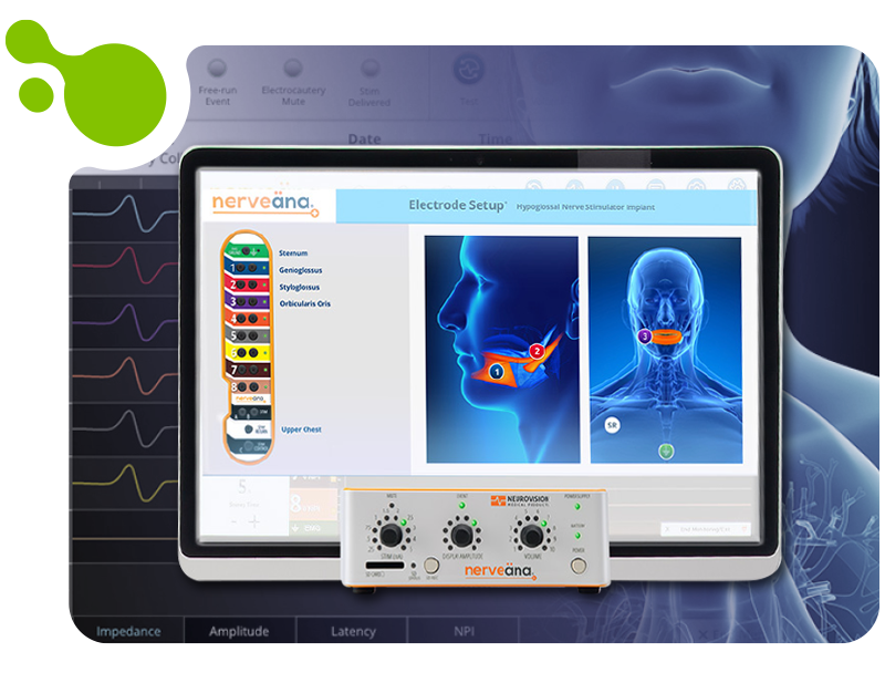 neuromonitoreo